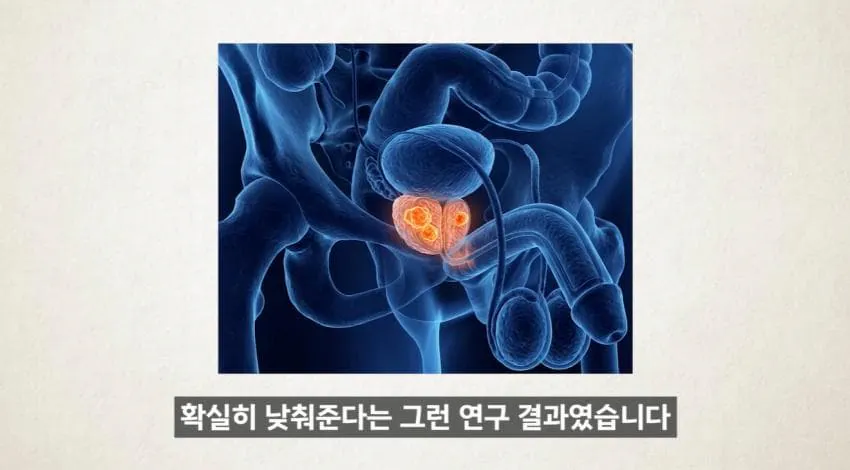 image.png 한달에 21번 사정해라