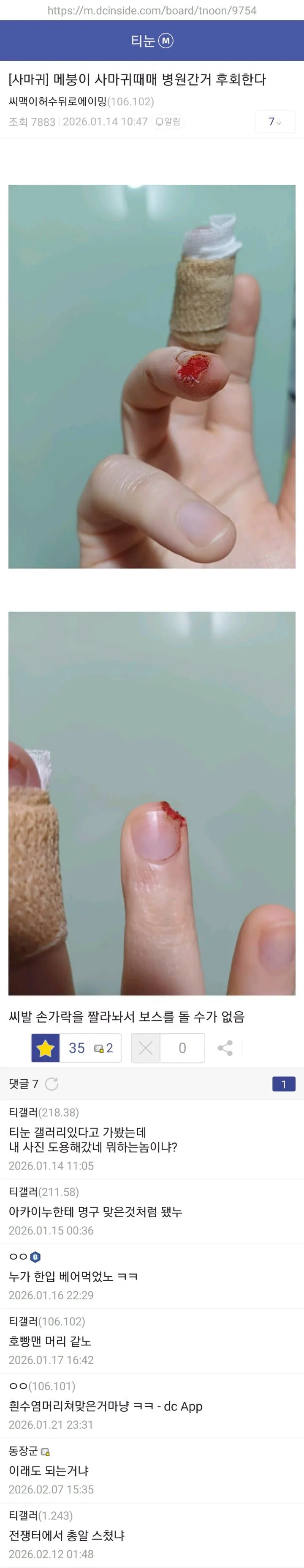 e4ed33c7ffef0567f9f5cb60d8e2488f.jpg 약혐) 티눈갤 형님들 ㄷㄷㄷ.jpg