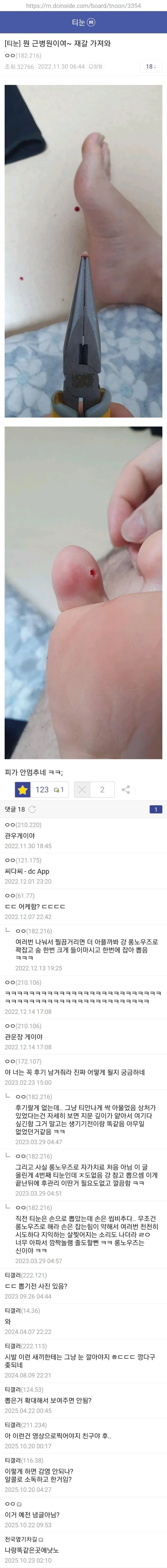 a20f4a7d43f8d8781caaa599b7dc2ae2.jpg 약혐) 티눈갤 형님들 ㄷㄷㄷ.jpg