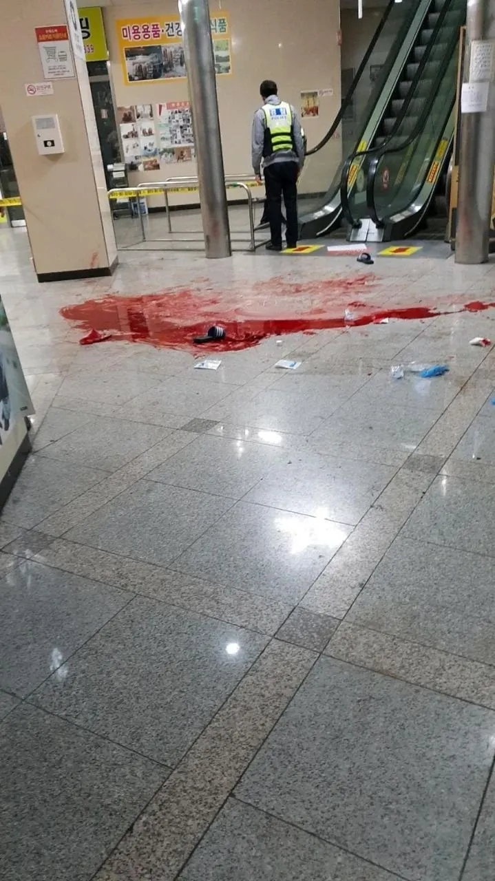 혐짤주의) 인식보다 훨씬 잔인했던 사건