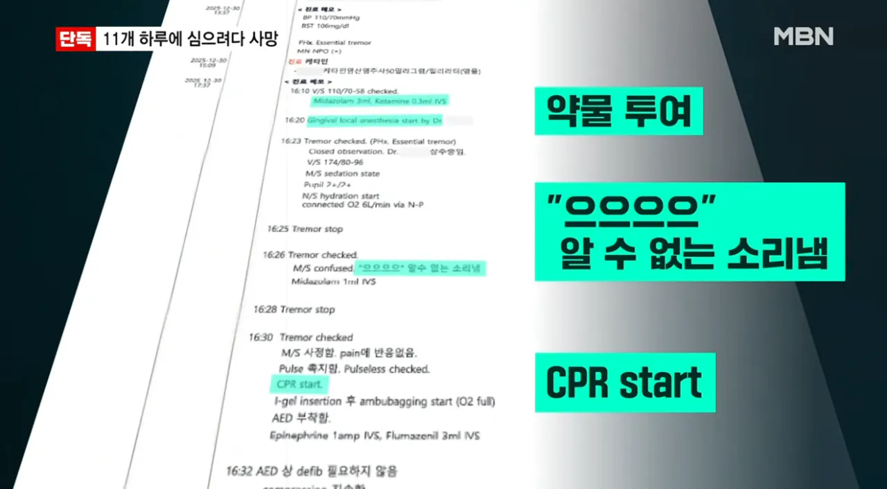 [단독] 임플란트 11개 하루에 심으려다 사망…국과수 마취제 독성 때문 (3).png [단독] 임플란트 11개 하루에 심으려다 사망 국과수 마취제 독성 때문