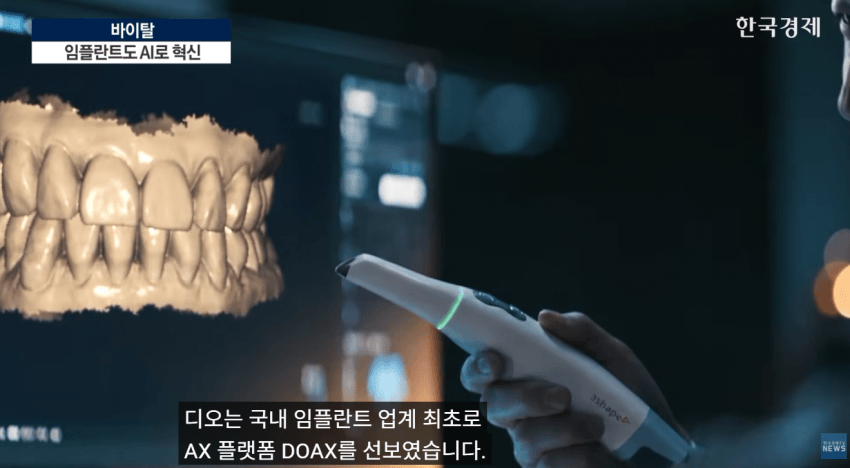 임플란트도 AI가 대세!!  **이제 수술 하루 만에 끝낸다**