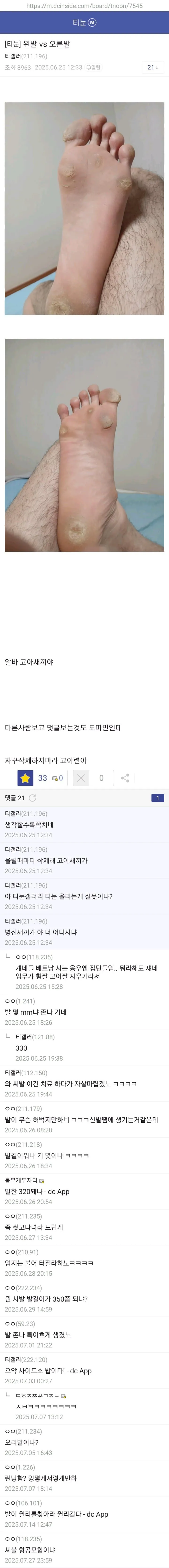 5bbc145888a22c9acb7d55d61b8ed2a2.jpg 약혐) 티눈갤 형님들 ㄷㄷㄷ.jpg