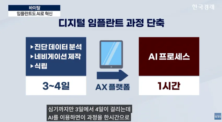 임플란트도 AI가 대세!!  **이제 수술 하루 만에 끝낸다**