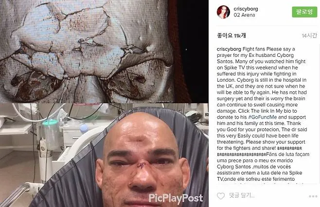 UFC 009.jpg ๋๊ฐ๊ณจ์ด ๋ถ์์ก๋ค๋ KO ์ฅ๋ฉด