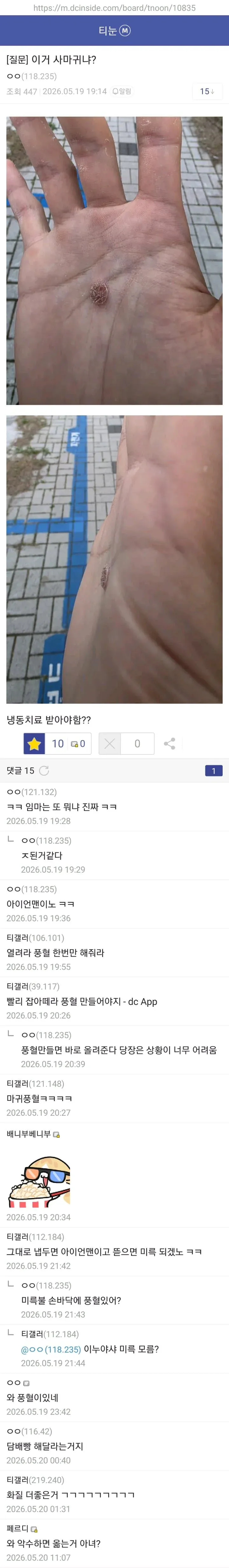 d9843ed6777102e518e7d60208a9f3d0.webp 약혐) 티눈갤 형님들 ㄷㄷㄷ.jpg