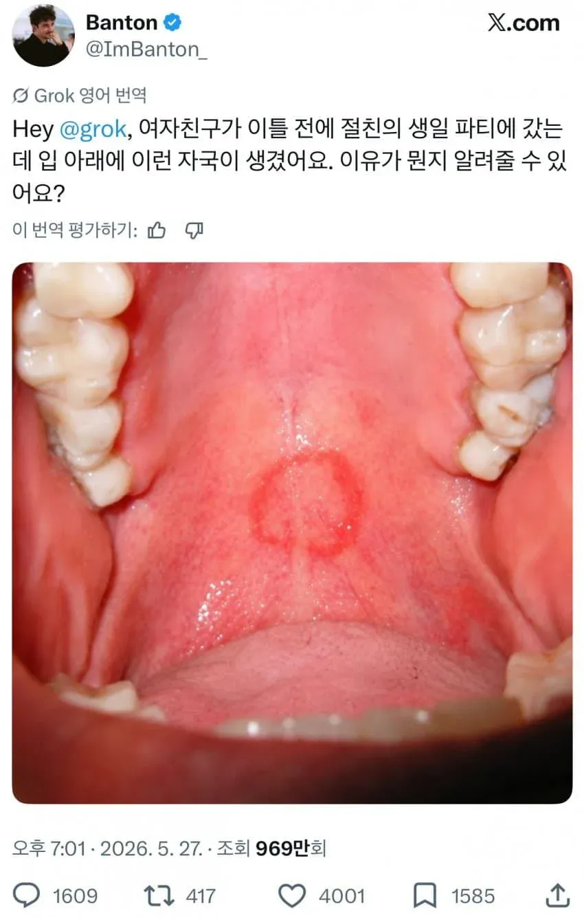 6262.webp 여자친구의 입에 이상한 자국이 생겼어요