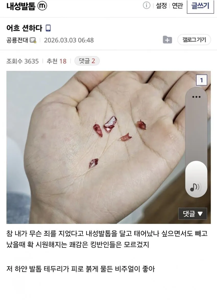 6eab15eb6a96ba68eda8bafc96055d60.jpg (혐) 인간의 정신력을 볼 수 있는 갤러리