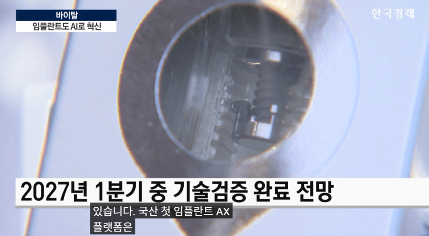 임플란트도 AI가 대세!!  **이제 수술 하루 만에 끝낸다**
