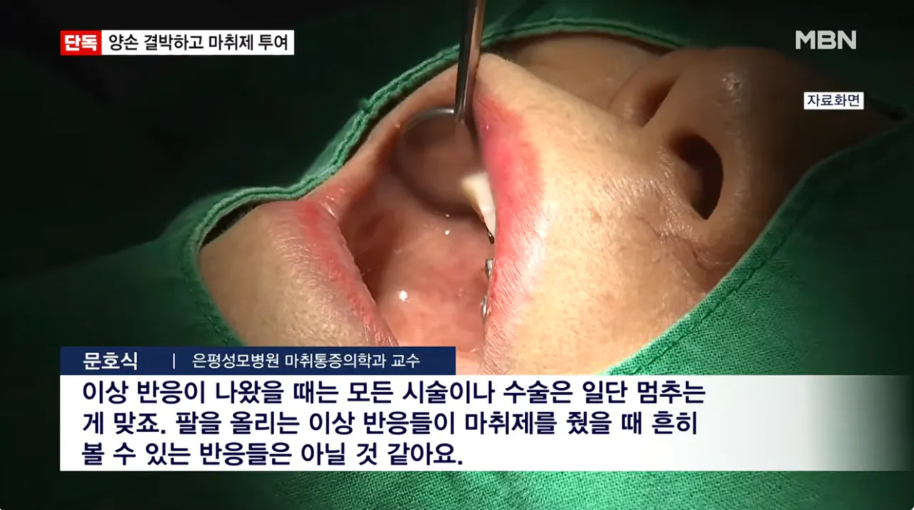 [단독] 임플란트 사망 사고 영상 봤더니…손목 결박 후 마취제 투여 (12).png [단독] 임플란트 사망 CCTV 봤더니 손목 결박 후 마취제 투여