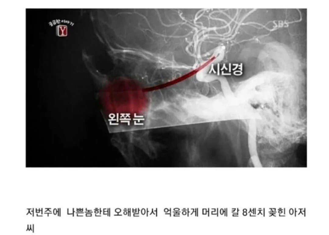 Screenshot_20250113_200226_Samsung Internet.jpg ์นผ๋ถ๋ฆผ 3ํ ,์คํ ํน ๋ฐฉํ๋ฒ ์กฐํ๋ณํ์๊ฐ ํ๋ ค๋๋์ด์ ๋ฌป์ง๋ง ์นผ๋ถ๋ฆผํ๋ ์ ์ ์งํ์๋ค์ด ๊ธธ๋ฐ์ ๋์๋ค๋๋์ด์ .jpg