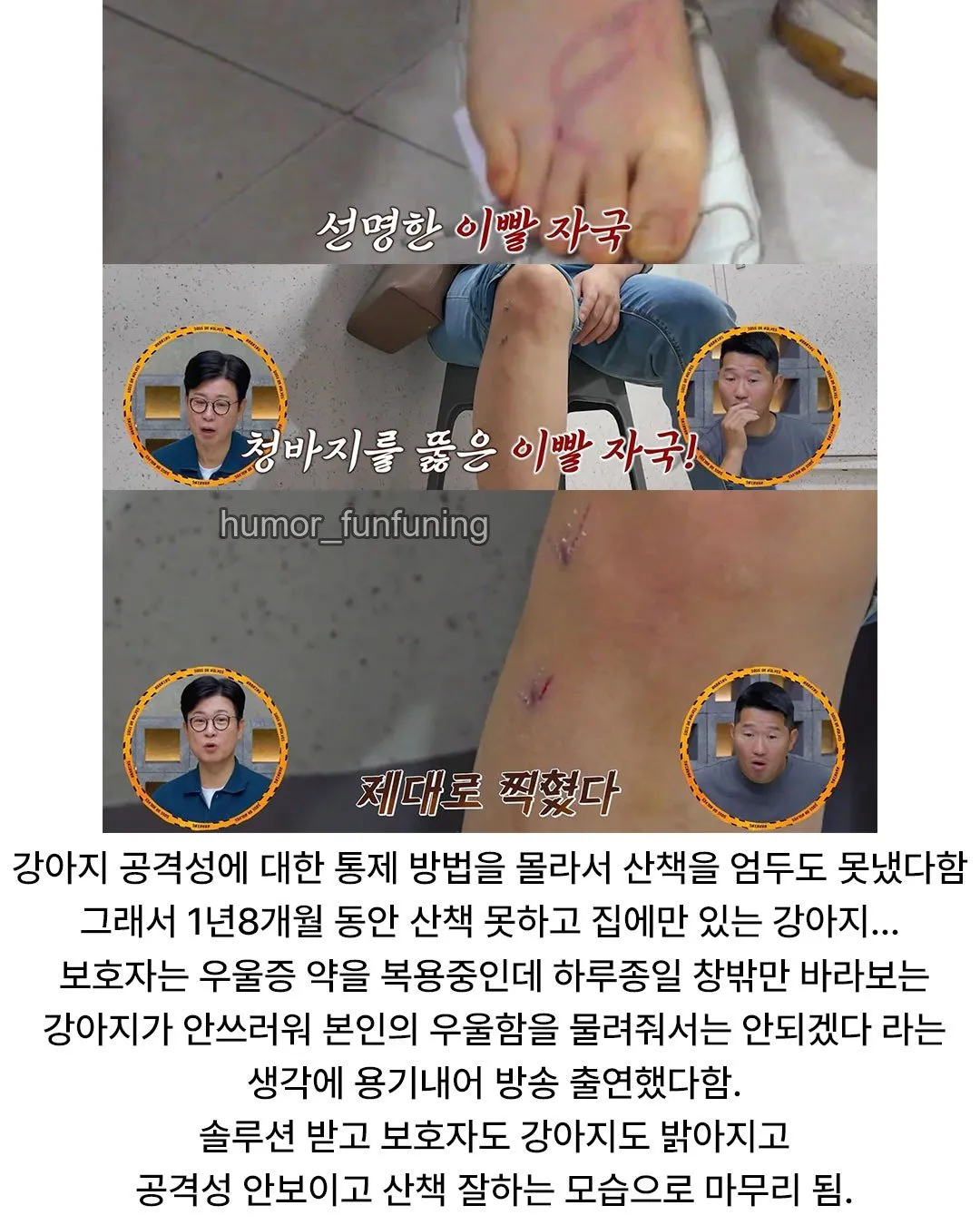 6513.jpg 강아지가 10분만 물면 더이상 안문다고 그냥 물리라고 하는 보호자 ㄷㄷ