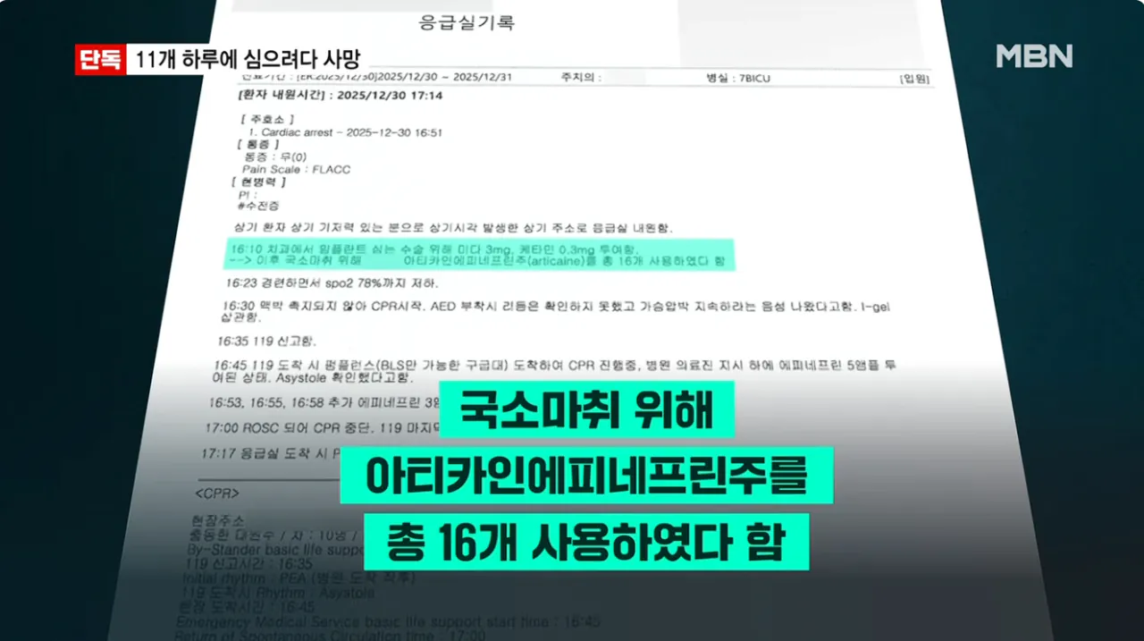 [단독] 임플란트 11개 하루에 심으려다 사망…국과수 마취제 독성 때문 (4).png [단독] 임플란트 11개 하루에 심으려다 사망 국과수 마취제 독성 때문