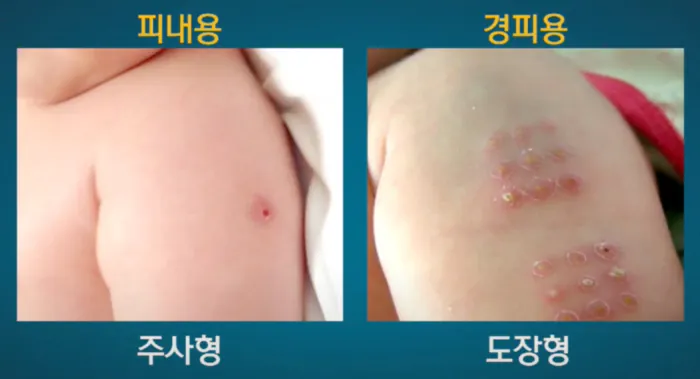 불주사.png 전국적으로 했지만 은근히 위험했던 거