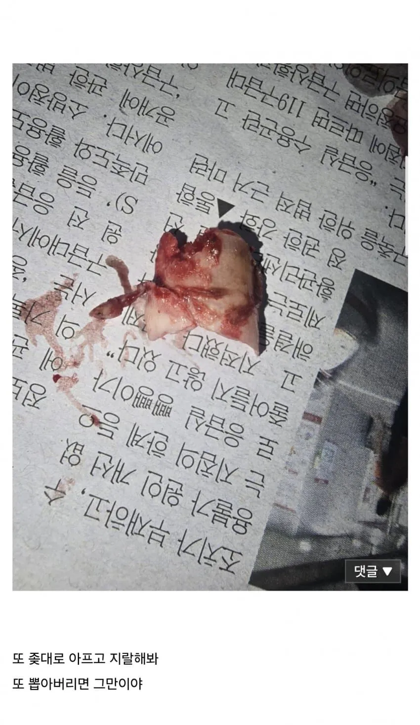 47ade9b1a2d525be34d0a8444612cb49.jpg (혐) 인간의 정신력을 볼 수 있는 갤러리