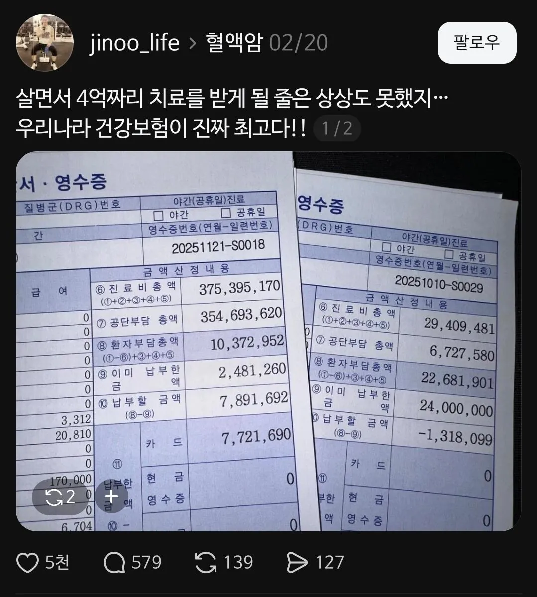 45067.jpg 4억 짜리 병원비, 실제 납부액 ㄷㄷ