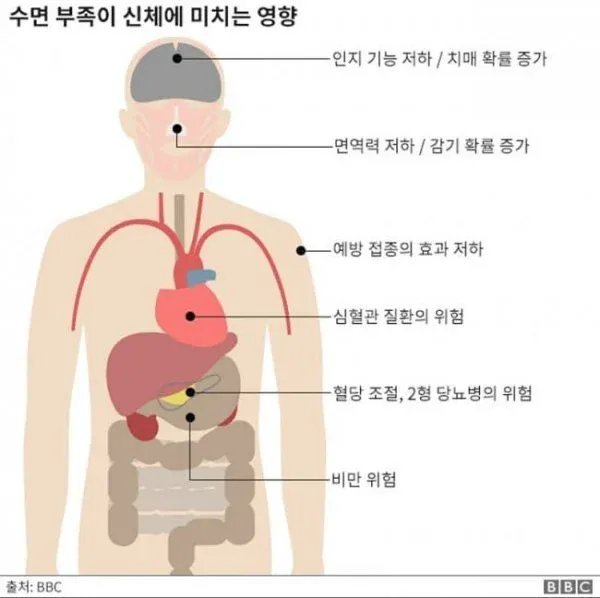 1.webp 수면 부족이 신체에 미치는 영향