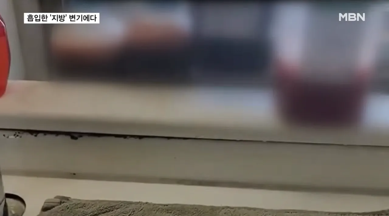 흡입한 지방 변기에 '콸콸'…불법 성형외과 무더기 적발 (4).png 지방흡입으로 빼낸 지방을 하수구 . 변기에 버린 병원들