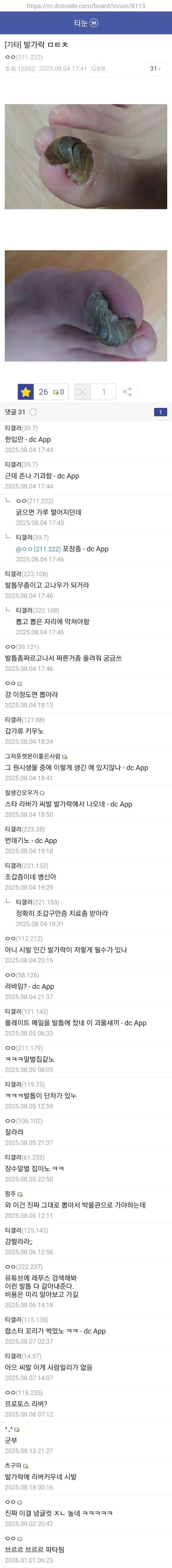 99b88807a70740a349d86e62d1797d7e.jpg 약혐) 티눈갤 형님들 ㄷㄷㄷ.jpg