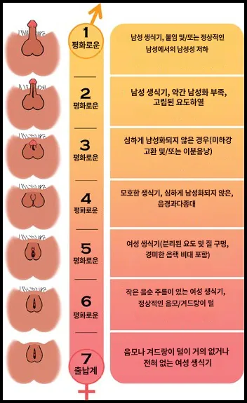 image.png 남자인데 여자로 태어나는 증후군 알아보기.jpg