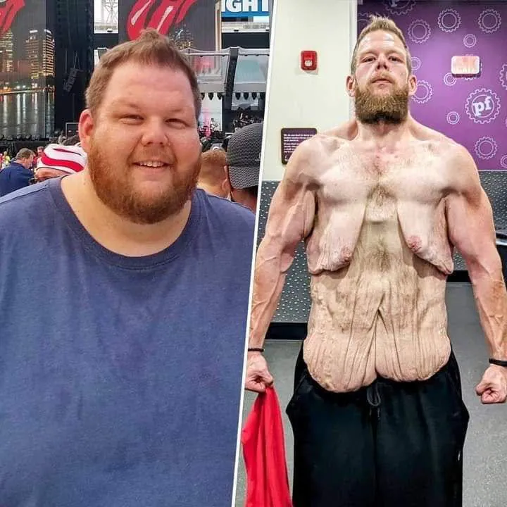 815febf5e4ca1542b33fc7d153ae53a2.jpg 약혐) 163kg 빼고 팬들에게 후원 부탁하는 스트리머