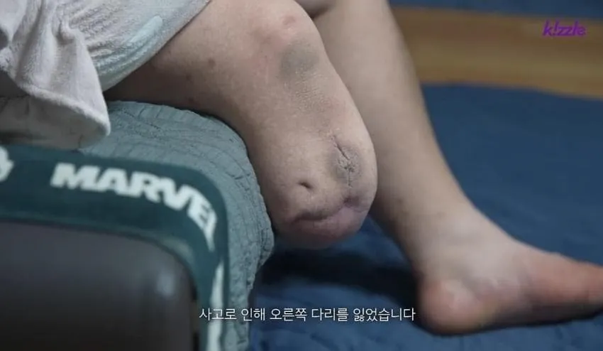 image.png 다리가 절단된 조선업 청년.jpg
