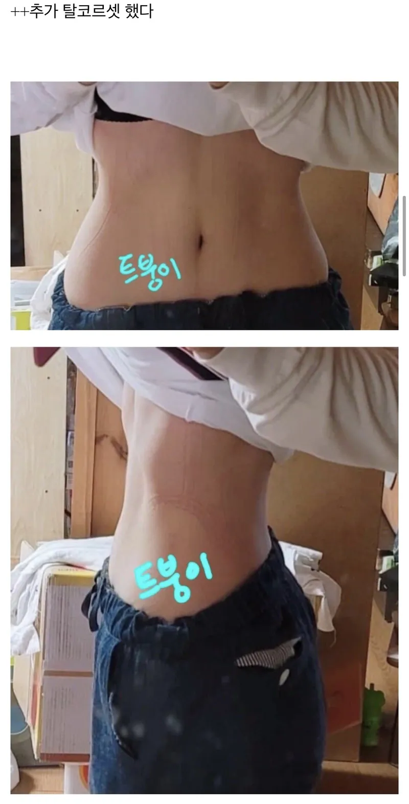 image-9.png ㅇㅎ?) 탈 코르셋 후기.jpg