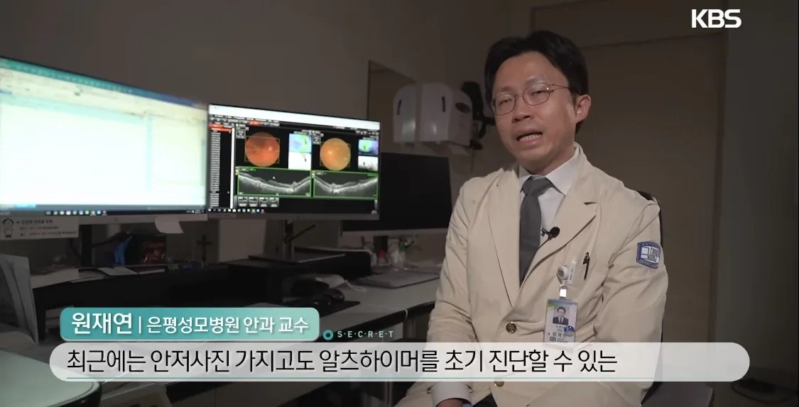 IMG_3914.jpeg 안과에서 초기 알츠하이머 진단하는 방법