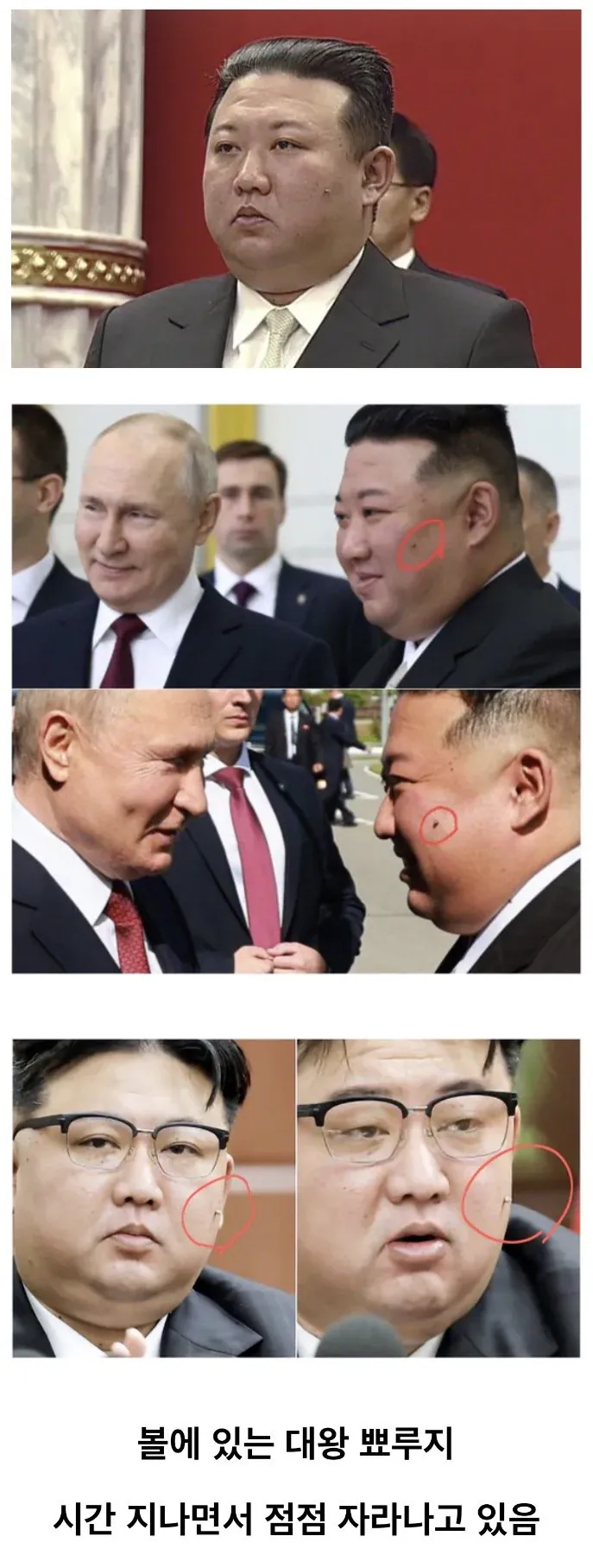 IMG_6306.jpeg 김정은 얼굴에서 점점 자라나고 있는 것 ㄷㄷㄷㄷㄷ