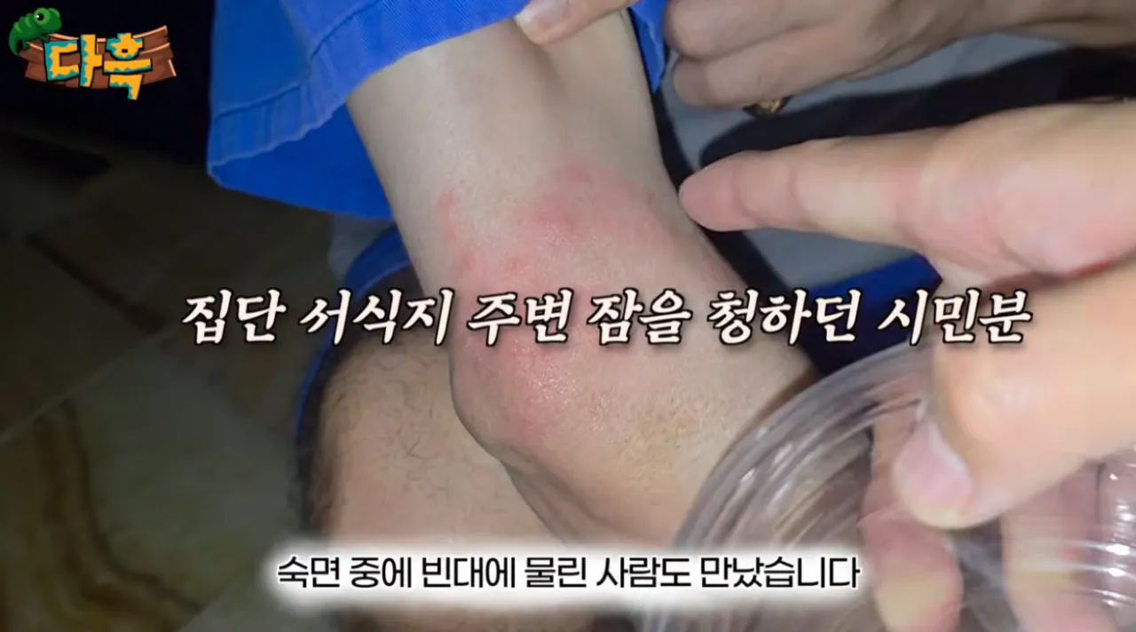 5.png 벌레/혐 주의) 부산 찜질방에 난리났다는 빈대 ㄷㄷ