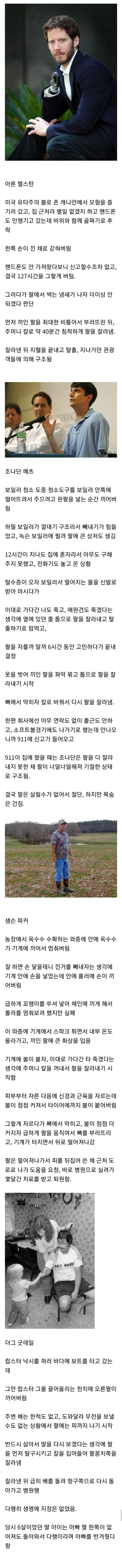 1.jpg 살기 위해 스스로 팔을 잘라낸 사람들 살기 위해 스스로 팔을 잘라낸 사람들