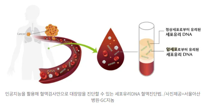 image.png 대장암 10명 중 9명 잡아냈다...내시경 없이 '피 한 번' 뽑으면 끝