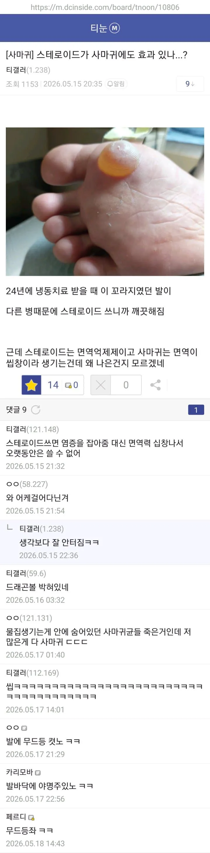 fde3b9d246926548eabd8ea2dede66e9.jpg 약혐) 티눈갤 형님들 ㄷㄷㄷ.jpg