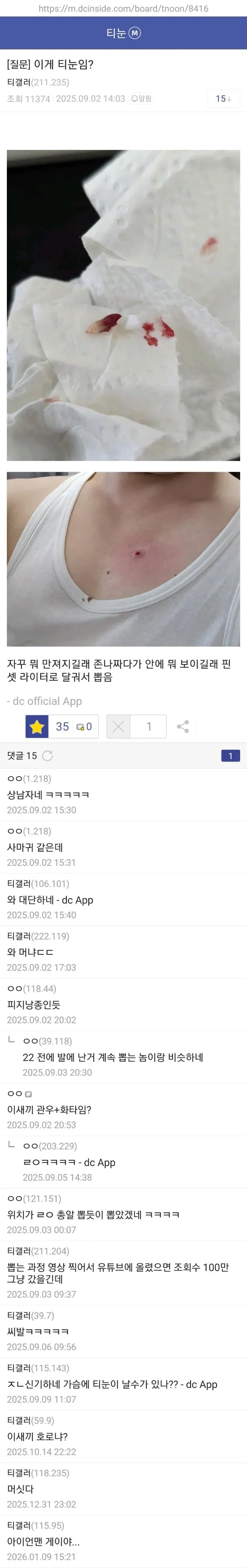 ad7cb65d3f79f61029ec3009fa828230.webp 약혐) 티눈갤 형님들 ㄷㄷㄷ.jpg