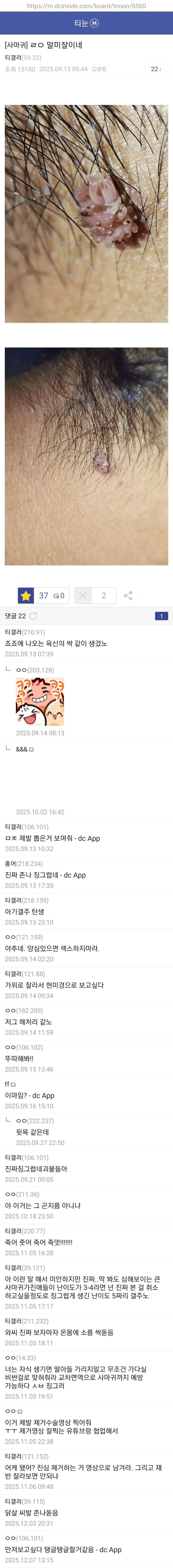 dd126d39e1fa42ed51c1509afd63a95b.jpg 약혐) 티눈갤 형님들 ㄷㄷㄷ.jpg