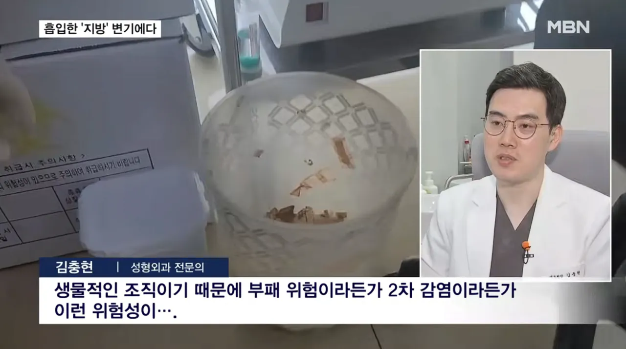 흡입한 지방 변기에 '콸콸'…불법 성형외과 무더기 적발 (12).png 지방흡입으로 빼낸 지방을 하수구 . 변기에 버린 병원들