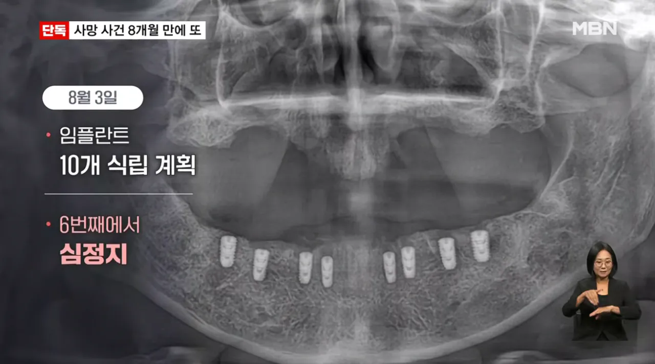 [단독] 강남 치과서 8개월 새 2명 사망…그런 일 없어요 발뺌 (9).png [단독] 강남 같은 치과서 8개월 새 2명 사망…그런 일 없어요 발뺌