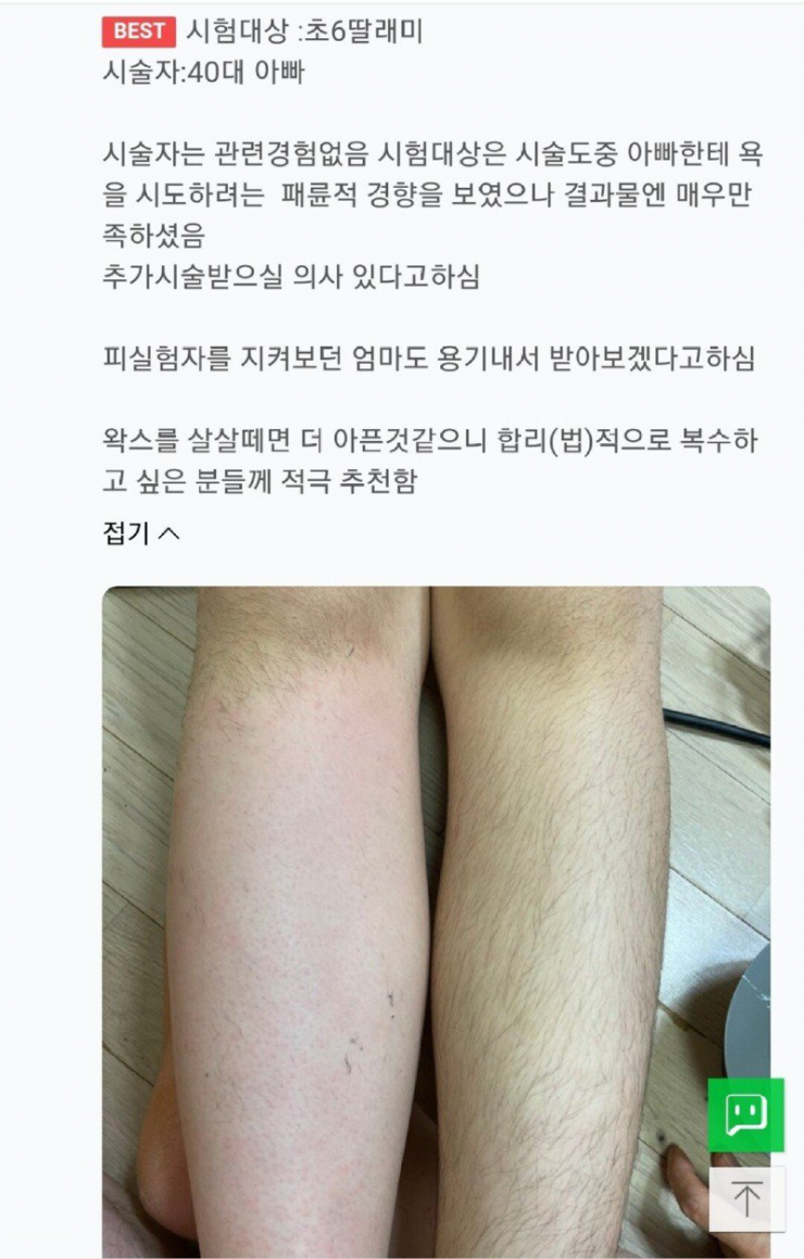 1.webp 초6 딸내미 왁싱해준 40대 아빠