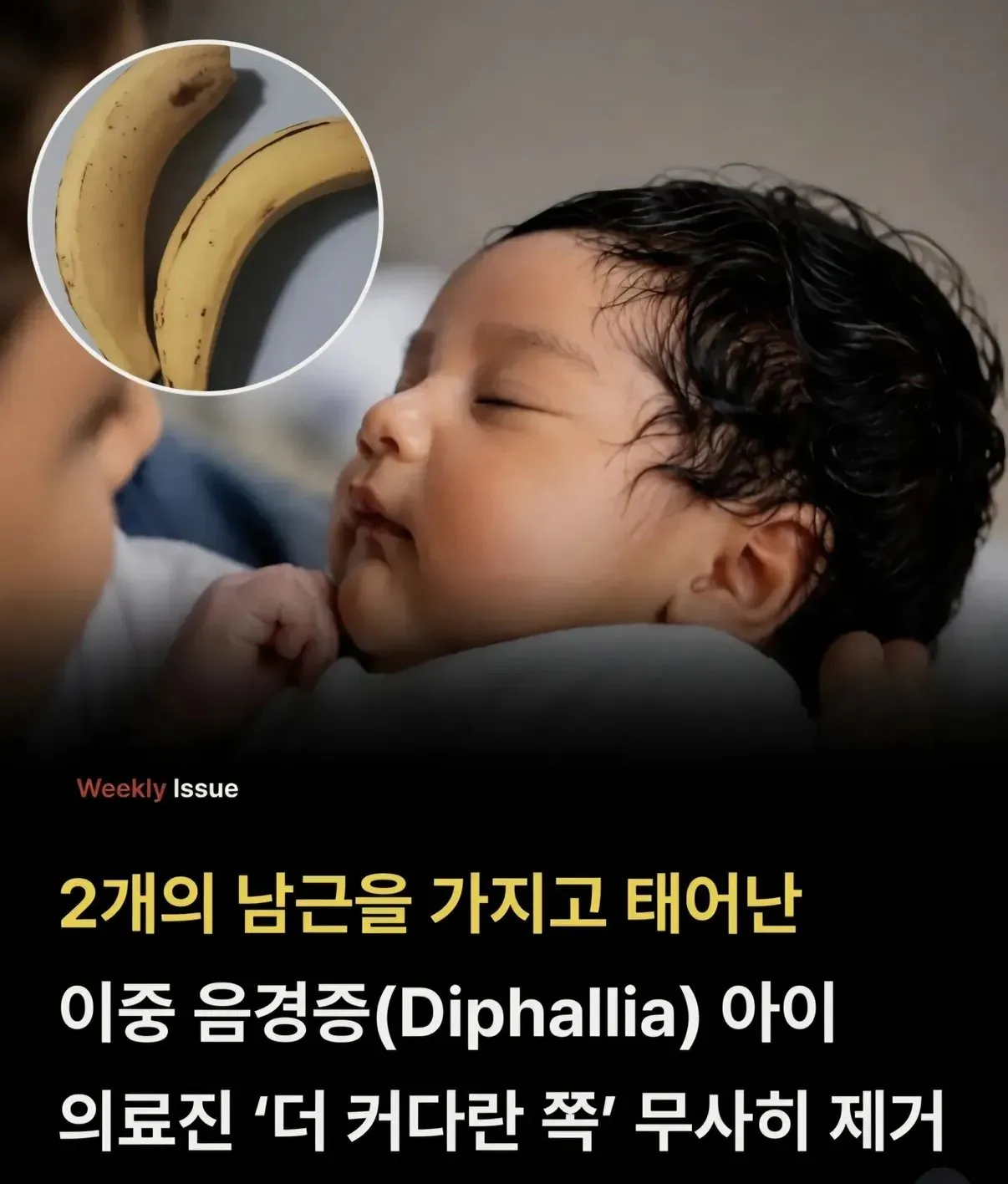 IMG_2716.jpeg 2개의 고추를 가지고 태어난 아이.jpg