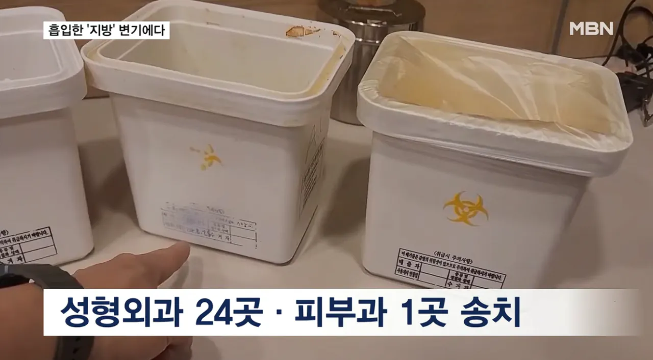 흡입한 지방 변기에 '콸콸'…불법 성형외과 무더기 적발 (13).png 지방흡입으로 빼낸 지방을 하수구 . 변기에 버린 병원들