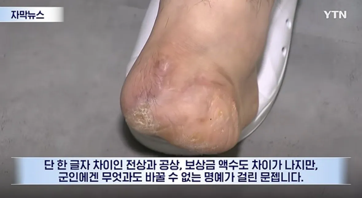 IMG_3717.jpeg 나라 지키다 발 잃었는데..."북한군 지뢰라는 증거 가져와라"