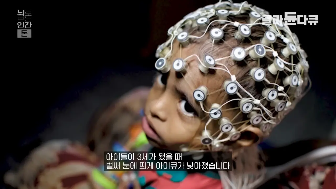 "가난할수록 지능이 낮다" 라는 연구결과 ㄷㄷㄷㄷ