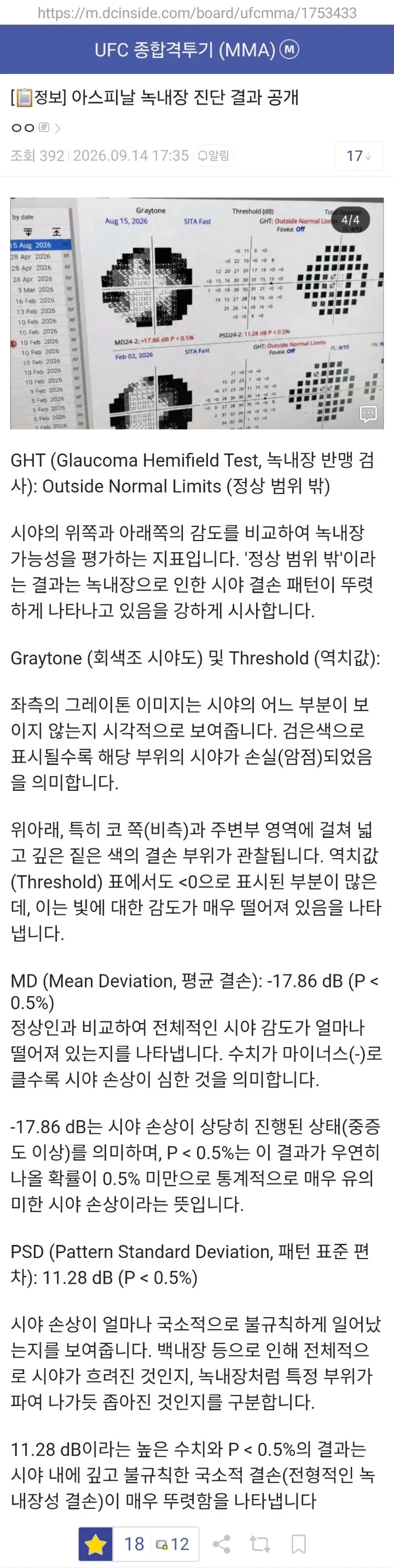 1000150437.jpg 속보) UFC 헤비급 챔피언 톰 아스피날 벨트 포기하겠다 선언 ㄷㄷ