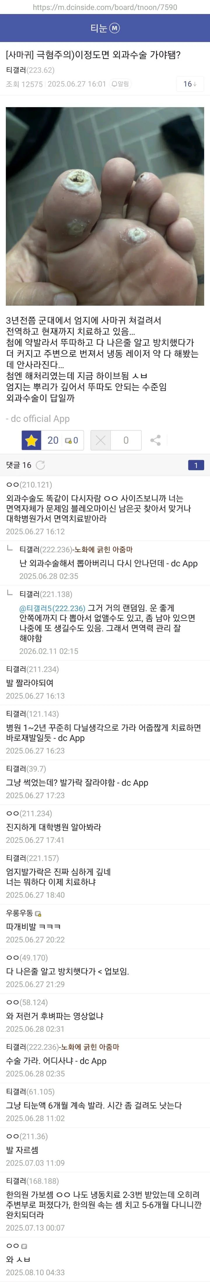 3b614a166b86f63be38a380ff8e551bb.jpg 약혐) 티눈갤 형님들 ㄷㄷㄷ.jpg